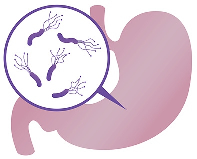 ピロリ菌イメージ